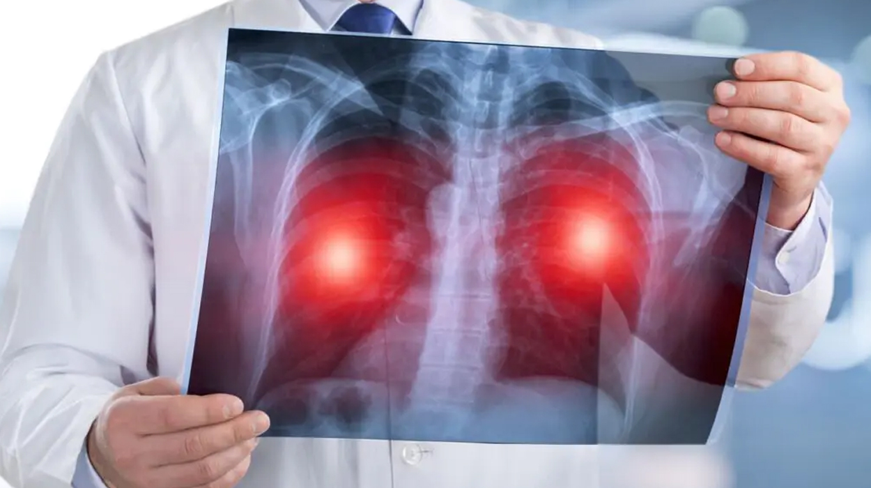 CMS Hospital Pulmonology